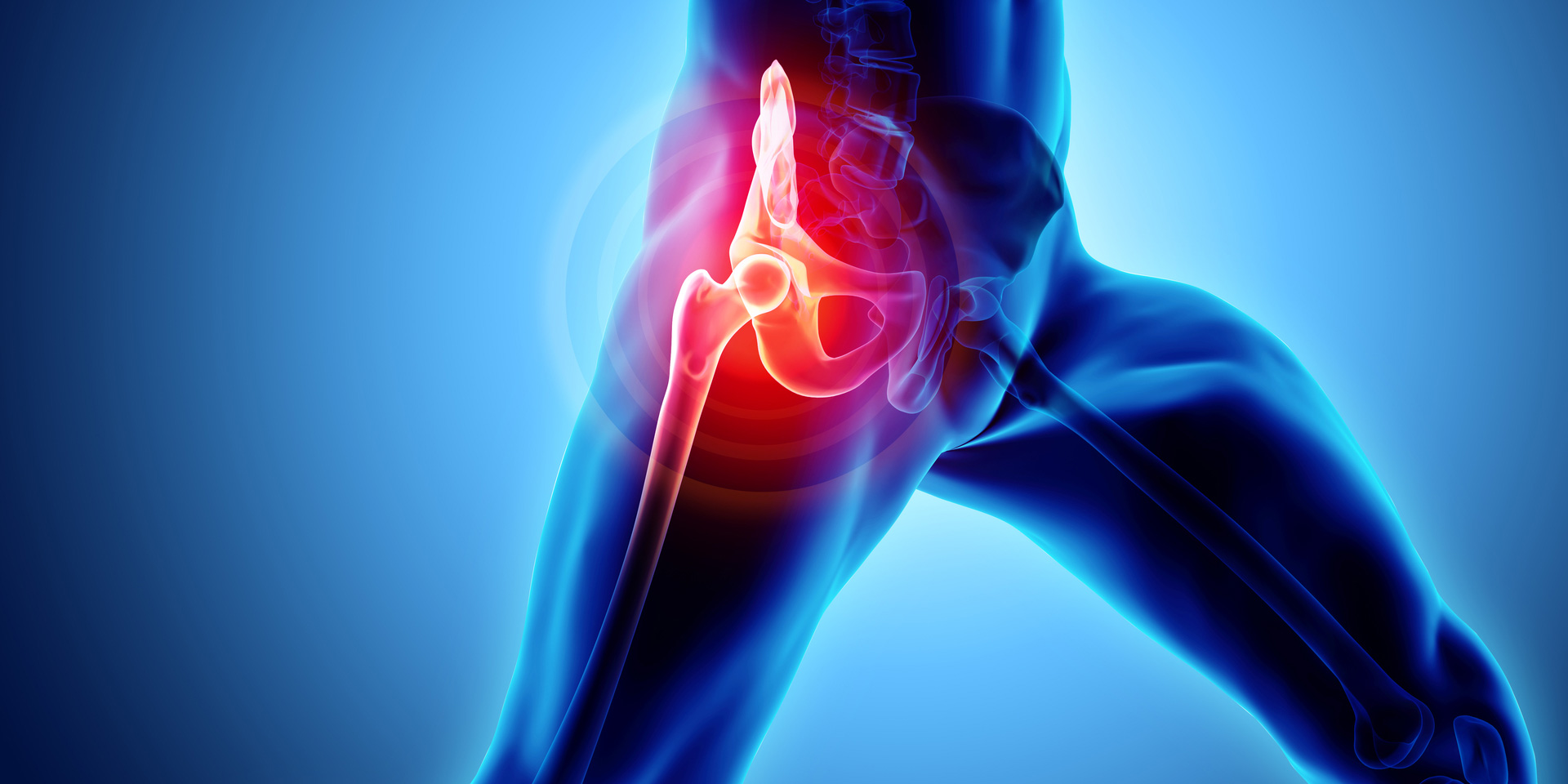 Hip Joint Pain Anatomy